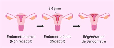 endometre epais a la menopause